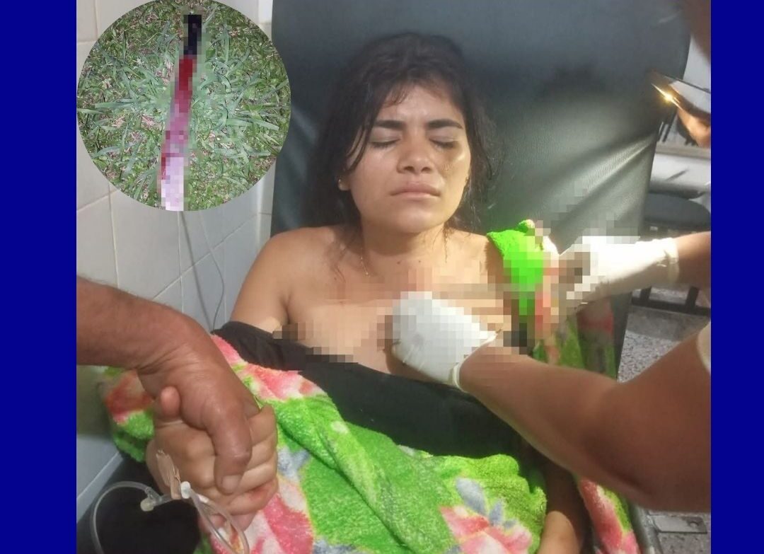 JOVEN DE 19 AÑOS SOBREVIVE A PRESUNTO ATAQUE CON MACHETE DE SU PAREJA EN CONCEPCIÓN